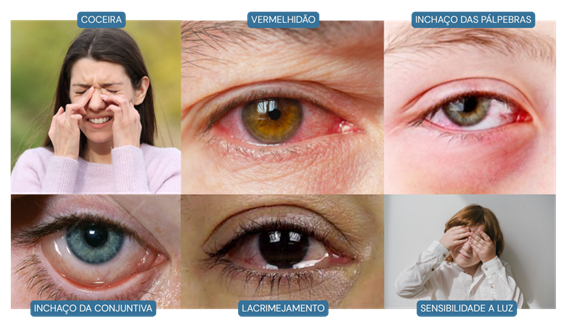 alergia sintomas