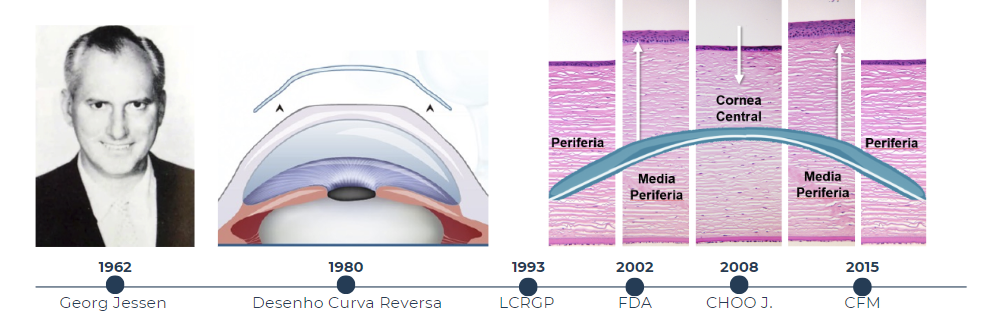 Ortoceratologia e sua história