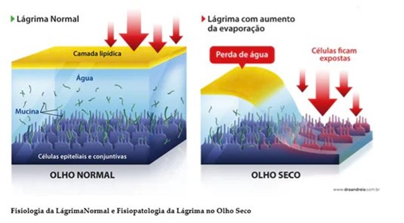 olho seco